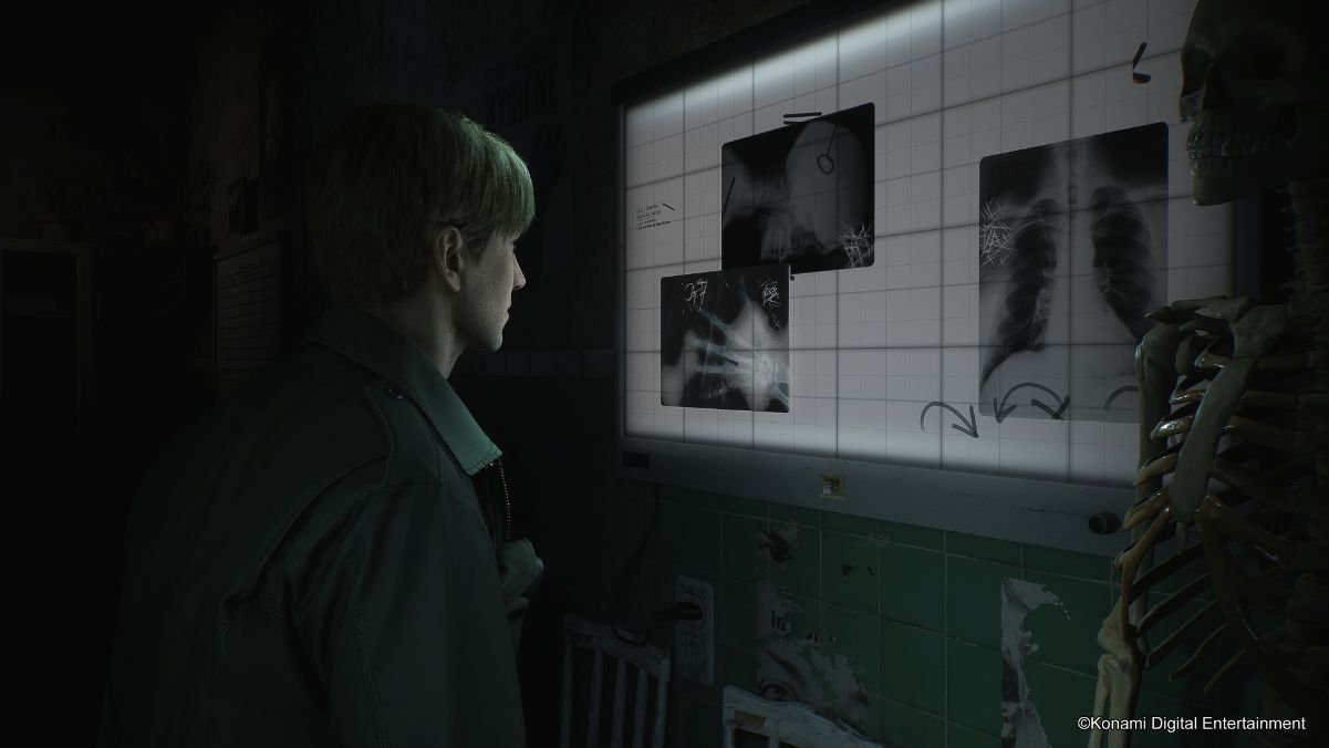 Silent Hill 2 - revisão médica